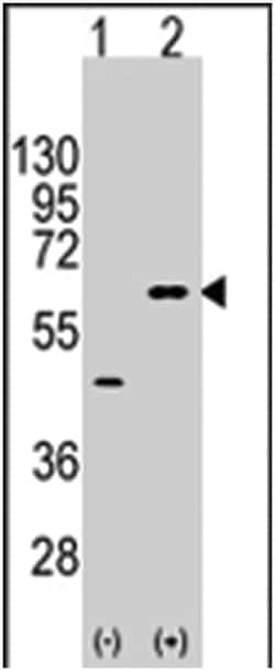 AKT3 Rabbit anti-Human, Polyclonal Antibody, Abnova 400 &mu;L | Buy Online | Abnova | Fisher Scientific