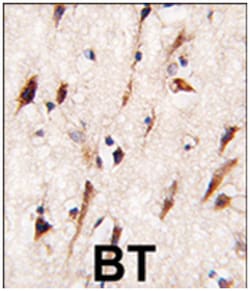 MOBKL1A, Rabbit, Polyclonal Antibody, Abnova 400 &mu;L | Buy Online | Abnova Corporation | Fisher Scientific