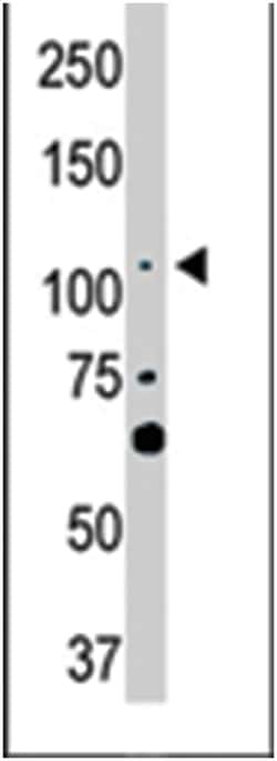 LATS2, Rabbit, Polyclonal Antibody, Abnova 400 &mu;L | Buy Online | Abnova Corporation | Fisher Scientific