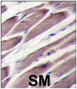 LATS2, Rabbit, Polyclonal Antibody, Abnova 400 &mu;L | Buy Online | Abnova Corporation | Fisher Scientific