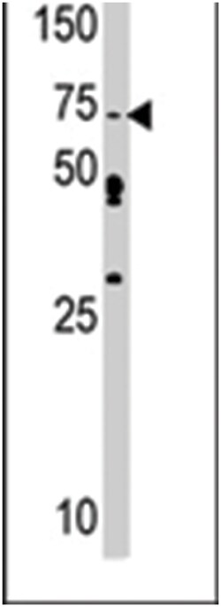 SRPK1 Rabbit anti-Human, Polyclonal Antibody, Abnova 400 &mu;L | Buy Online | Abnova Corporation | Fisher Scientific