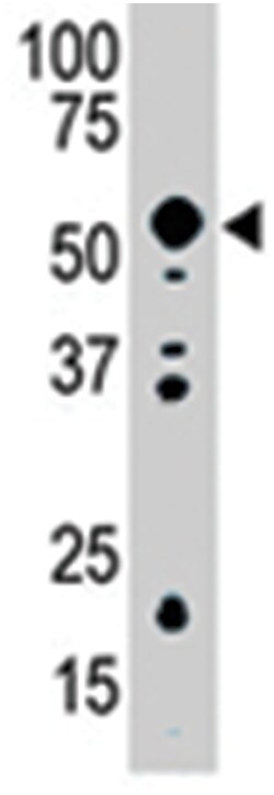 PDK2, Rabbit, Polyclonal Antibody, Abnova 400&mu;L; Unlabeled:Antibodies,