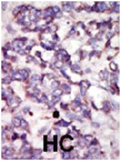 PDK2, Rabbit, Polyclonal Antibody, Abnova 400&mu;L; Unlabeled:Antibodies,