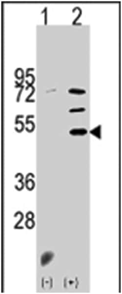 PDK3, Rabbit, Polyclonal Antibody, Abnova 400 &mu;L | Buy Online | Abnova Corporation | Fisher Scientific