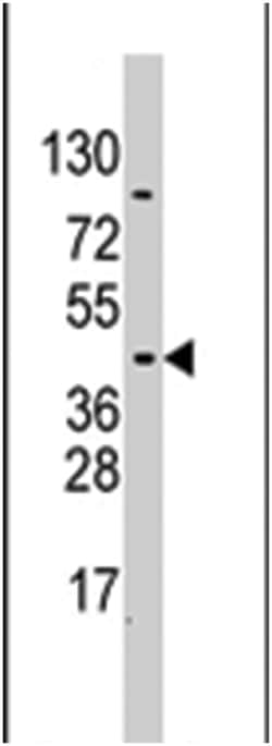 PDK4 Rabbit anti-Human, Polyclonal Antibody, Abnova 400 &mu;L | Buy Online | Abnova Corporation | Fisher Scientific
