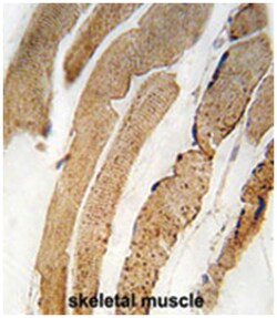 PDK4 Rabbit anti-Human, Polyclonal Antibody, Abnova 400 &mu;L | Buy Online | Abnova Corporation | Fisher Scientific