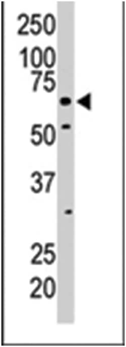 PKLR Rabbit anti-Human, Mouse, Polyclonal Antibody, Abnova 400 &mu;L | Buy Online | Abnova Corporation | Fisher Scientific