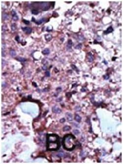 PKLR Rabbit anti-Human, Mouse, Polyclonal Antibody, Abnova 400 &mu;L | Buy Online | Abnova Corporation | Fisher Scientific