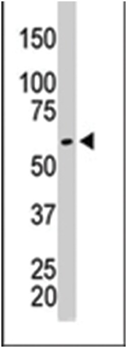 PKM2 Rabbit anti-Human, Monkey, Mouse, Rat, Polyclonal Antibody, Abnova 400 &mu;L | Buy Online | Abnova Corporation | Fisher Scientific
