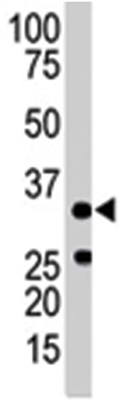 PRKAB1 Rabbit anti-Human, Mouse, Polyclonal Antibody, Abnova 400 &mu;L | Buy Online | Abnova Corporation | Fisher Scientific