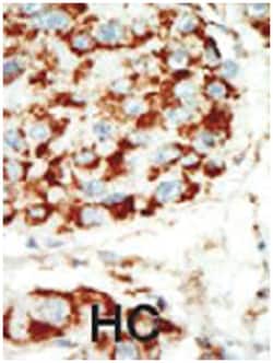 PRKAB1 Rabbit anti-Human, Mouse, Polyclonal Antibody, Abnova 400 &mu;L | Buy Online | Abnova Corporation | Fisher Scientific