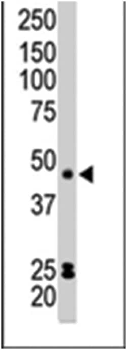 PRKACB, Rabbit, Polyclonal Antibody, Abnova 400 &mu;L | Buy Online | Abnova Corporation | Fisher Scientific