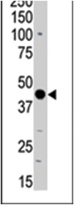 PRKAR2B Rabbit anti-Human, Mouse, Polyclonal Antibody, Abnova 400&mu;L;