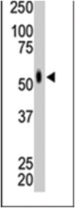 MKNK2 Rabbit anti-Human, Polyclonal Antibody, Abnova 400 &mu;L | Buy Online | Abnova Corporation | Fisher Scientific