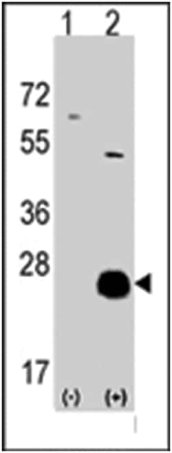 CSNK2B Rabbit anti-Human, Polyclonal Antibody, Abnova 400 &mu;L | Buy Online | Abnova Corporation | Fisher Scientific