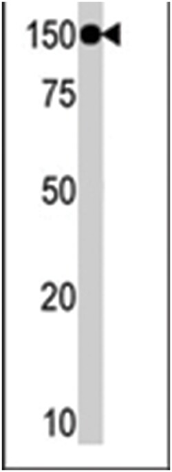TAOK1 Rabbit anti-Human, Polyclonal Antibody, Abnova 400 &mu;L | Buy Online | Abnova Corporation | Fisher Scientific