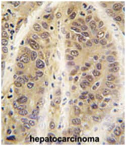ADK Rabbit anti-Human, Polyclonal Antibody, Abnova 400&mu;L; Unlabeled:Antibodies,