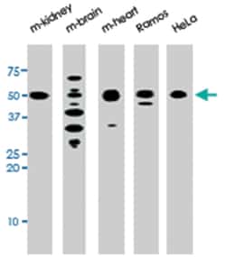 park, Rabbit, Polyclonal Antibody, Abnova 400&mu;L; Unlabeled:Antibodies,