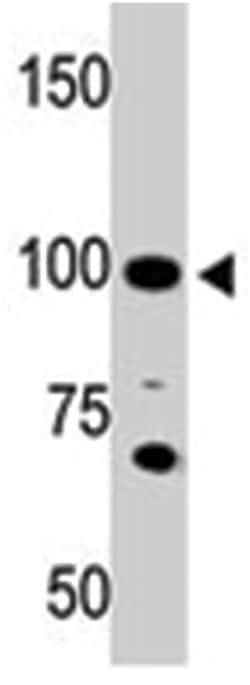 ACE2 Rabbit anti-Human, Polyclonal Antibody, Abnova 400 &mu;L | Buy Online | Abnova Corporation | Fisher Scientific