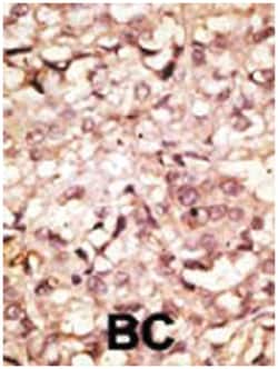 ACE2 Rabbit anti-Human, Polyclonal Antibody, Abnova 400 &mu;L | Buy Online | Abnova Corporation | Fisher Scientific