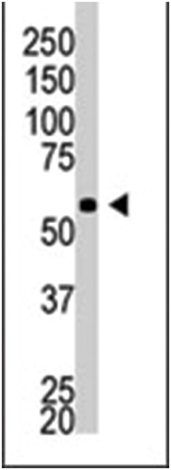 BACE2 Rabbit anti-Human, Polyclonal Antibody, Abnova 400&mu;L; Unlabeled:Antibodies,