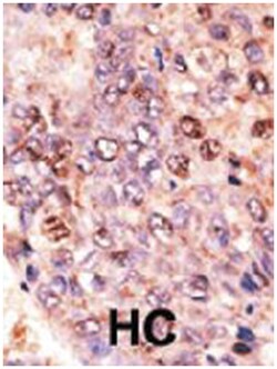 ABCB7 Rabbit anti-Human, Polyclonal Antibody, Abnova 400&mu;L; Unlabeled:Antibodies,