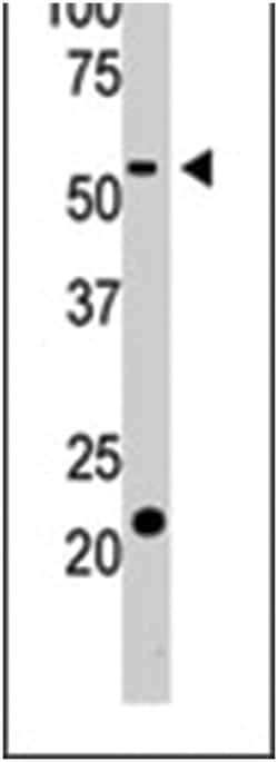 BACE2 Rabbit anti-Human, Polyclonal Antibody, Abnova 400&mu;L; Unlabeled:Antibodies,