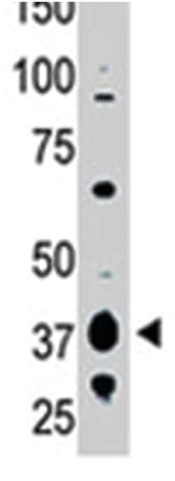 LPAR1, Rabbit, Polyclonal Antibody, Abnova 400 &mu;L | Buy Online | Abnova Corporation | Fisher Scientific