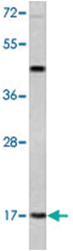 LEP Rabbit anti-Human, Polyclonal Antibody, Abnova 400 &mu;L | Buy Online | Abnova Corporation | Fisher Scientific