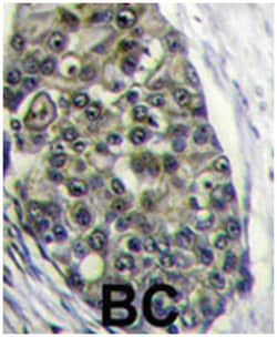 LRP6 Rabbit anti-Human, Polyclonal Antibody, Abnova 400 &mu;L | Buy Online | Abnova Corporation | Fisher Scientific