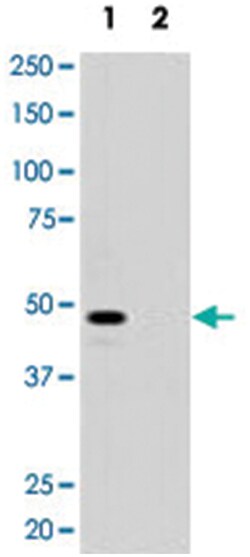 MAGEA11, Rabbit, Polyclonal Antibody, Abnova 400 &mu;L | Buy Online | Abnova Corporation | Fisher Scientific