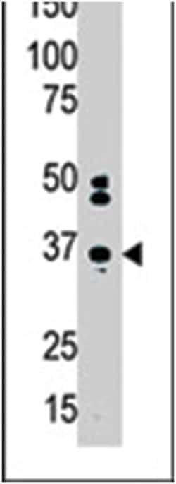 MAGEA2, Rabbit, Polyclonal Antibody, Abnova 400&mu;L; Unlabeled:Antibodies,