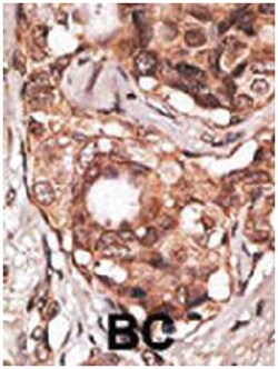 MAGEB2, Rabbit, Polyclonal Antibody, Abnova 400&mu;L; Unlabeled:Antibodies,