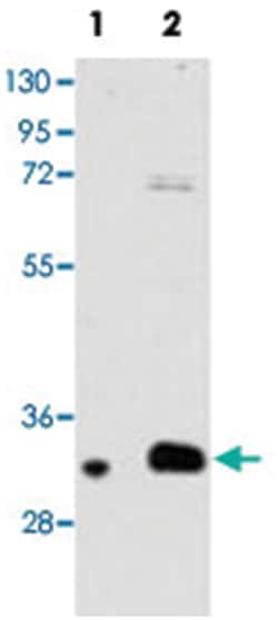 MAGEB2, Rabbit, Polyclonal Antibody, Abnova 400&mu;L; Unlabeled:Antibodies,