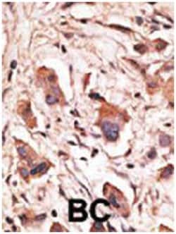 MAGED1, Rabbit, Polyclonal Antibody, Abnova 400 &mu;L | Buy Online | Abnova Corporation | Fisher Scientific