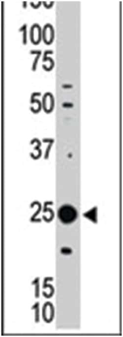 MAGEH1, Rabbit, Polyclonal Antibody, Abnova 400 &mu;L | Buy Online | Abnova Corporation | Fisher Scientific
