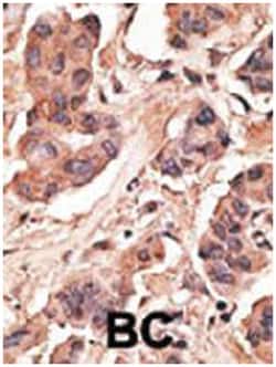MAGEH1, Rabbit, Polyclonal Antibody, Abnova 400 &mu;L | Buy Online | Abnova Corporation | Fisher Scientific