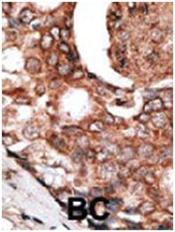 MLLT6, Rabbit, Polyclonal Antibody, Abnova 400&mu;L; Unlabeled:Antibodies,
