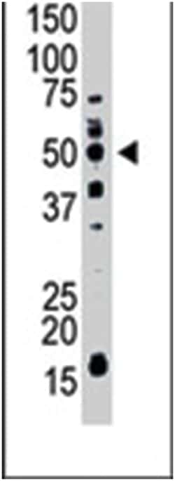 Abnova Corporation&nbsp;MMP11, Rabbit, Polyclonal Antibody, Abnova&trade;