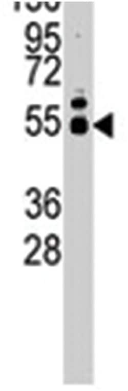 MMP12 Rabbit anti-Human, Mouse, Polyclonal Antibody, Abnova 400&mu;L; Unlabeled:Antibodies,
