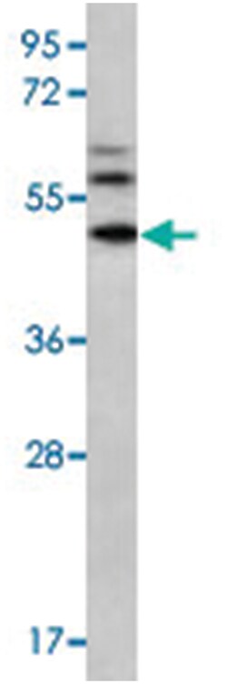 MMP16 Rabbit anti-Human, Polyclonal Antibody, Abnova 400&mu;L; Unlabeled:Antibodies,