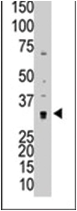 MMP7 Rabbit anti-Human, Polyclonal Antibody, Abnova 400 &mu;L | Buy Online | Abnova Corporation | Fisher Scientific