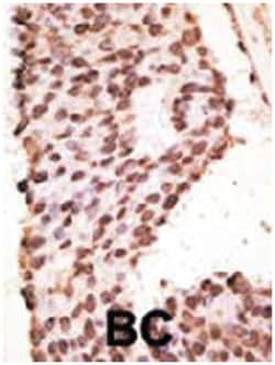 MMP7 Rabbit anti-Human, Polyclonal Antibody, Abnova 400 &mu;L | Buy Online | Abnova Corporation | Fisher Scientific