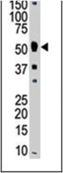 MMP8 Rabbit anti-Human, Mouse, Polyclonal Antibody, Abnova 400&mu;L; Unlabeled:Antibodies,