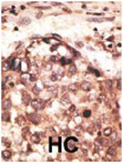 MMP8 Rabbit anti-Human, Mouse, Polyclonal Antibody, Abnova 400&mu;L; Unlabeled:Antibodies,