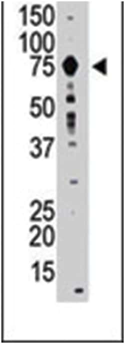MMP9 Rabbit anti-Human, Polyclonal Antibody, Abnova 400 &mu;L | Buy Online | Abnova Corporation | Fisher Scientific