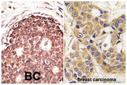 MMP9 Rabbit anti-Human, Polyclonal Antibody, Abnova 400 &mu;L | Buy Online | Abnova Corporation | Fisher Scientific