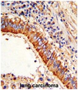 MVP Rabbit anti-Human, Polyclonal Antibody, Abnova 400 &mu;L | Buy Online | Abnova Corporation | Fisher Scientific