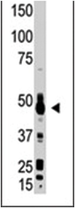 OAS1, Rabbit, Polyclonal Antibody, Abnova 400 &mu;L | Buy Online | Abnova Corporation | Fisher Scientific