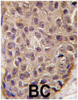 OAS1, Rabbit, Polyclonal Antibody, Abnova 400 &mu;L | Buy Online | Abnova Corporation | Fisher Scientific